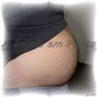 cuidado_gordura_abdominal_pode_causar_morte_prematura