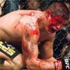 As lutas mais sangrentas da MMA – UFC & Pride em Fotos