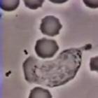 Glóbulo branco perseguindo uma bactéria