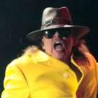 axl_rose_atual_
