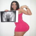 graciella_carvalho_prova_com_raio_x_que_seu_bumbum_e_natural_