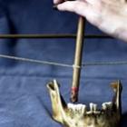 os_instrumentos_horripilantes_dos_dentistas_do_passado