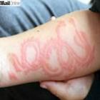 tatuagem_de_henna_em_menino_de_6_anos_deve_ficar_para_sempre_no_braco