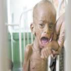 400_mil_criancas_podem_morrer_de_fome_na_somalia
