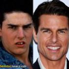 celebridades_antes_e_depois_de_ir_ao_dentista