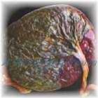 placenta_orgao_transitorio_que_mantem_a_gravidez