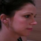 meu_antes_e_depois_da_plastica