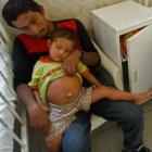 cirurgioes_peruanos_retiram_feto_do_abdomen_de_crianca_de_3_anos