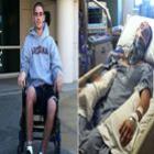 _jovem_dado_como_morto_acorda_do_coma_e_surpreende_medicos_e_a_familia