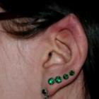 americana_faz_cirurgia_para_parecer_elfo