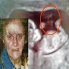rosto_de_mulher_morta_aparece_em_ultrassonografia_de_bebe