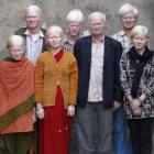 a_maior_familia_albina_do_mundo_