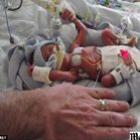 bebe_nasce_prematuro_com_450_gramas_e_sobrevive