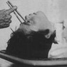 estranhas_praticas_da_medicina_no_passado