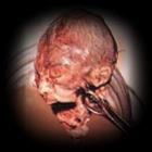 mulher_aborta_filho_e_esconde_o_feto_em_guardaroupa