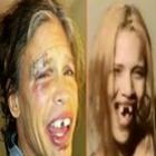 steven_tyler_cai_quebra_o_dente_e_fica_a_cara_da_gorete