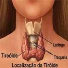 Doenças na Tireóide o Hipotiroidismo Adulto e Crianças