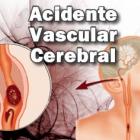 como_prevenir_um_acidente_vascular_cerebral_avc