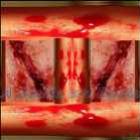 a_coagulacao_do_sangue_defesa_natural_do_organismo_contra_hemorragias