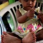 conheca_a_menina_chinesa_dos_26_dedos