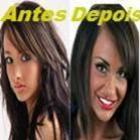 apos_gastar_r$_60_mil_em_cirurgias_modelo_admite_ser_viciada_em_plasticas