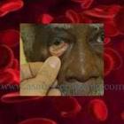 anemia_uma_das_doencas_do_sangue