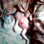 medico_do_samu_manda_mae_pegar_taxi_para_maternidade_e_bebe_morre