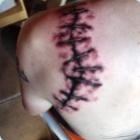 tatuagens_cirurgicas_2