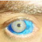 tatuando_a_parte_branca_dos_olhos