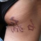 Chinês acorda com tatuagem misteriosa na nádega direita após cirurgia