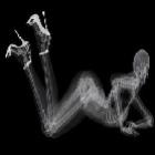 calendario_raiox_em_poses_sensuais