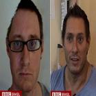 britanico_que_teve_cranio_reconstruido_com_gordura_conta_como_se_recuperou_