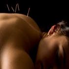 acupuntura_para_aumenta_a_libido