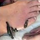 sanguessugas_sao_utilizadas_pela_medicina_para_curar_doencas