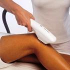 Dicas para ter uma pele suave e sem pelos através da fotodepilação