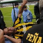 Cena Forte! Jogador sofre fratura dupla em campeonato no Uruguai.