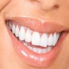 Dentes uma boa nutrição previne contra gengivite e cárie