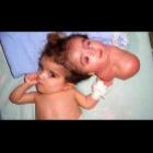 a_incrivel_luta_de_manar_maged_pela_sobrevivencia_11_imagens