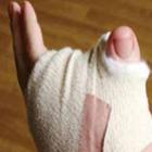 britanico_tem_dedao_do_pe_implantado_no_lugar_do_polegar