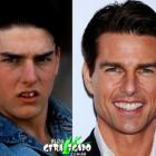 famosos_antes_e_depois_do_dentista_