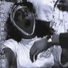 crise_de_epilepsia