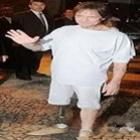 celebridades_brasileirasquanto_gringas_tambem_possuem_defeitos_bizarros__