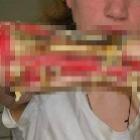 os_efeitos_devastadores_da_droga_krokodil_13_imagens