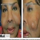 americano_fica_com_rosto_deformado_depois_de_contratar_falso_medico