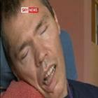 homem_sobrevive_a_23_anos_em_coma_consciente