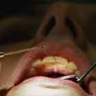 caries_sao_contagiosas