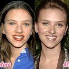 celebridades_antes_e_depois_da_plastica_2