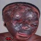 efeitos_da_radiacao_sao_devastadores_para_os_seres_humanos