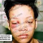 Novas fotos da agressão de Chris Brown em Rihanna
