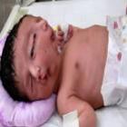 no_paquistao_bebe_nasce_com_duas_caras